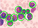 Blood Cell Identification using Image Processing